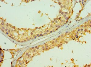TNFRSF13B / TACI Antibody - Immunohistochemistry of paraffin-embedded human testicle using antibody at 1:100 dilution.