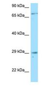TNFRSF13B / TACI Antibody - TNFRSF13B / TACI antibody Western Blot of THP-1.  This image was taken for the unconjugated form of this product. Other forms have not been tested.