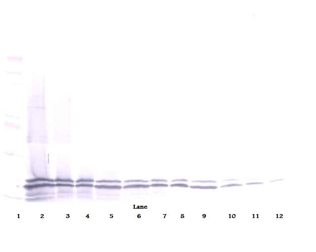 TNFRSF13B / TACI Antibody - Anti-Human TACI Western Blot Reduced