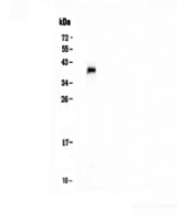 TNFRSF13B / TACI Antibody - Western blot - Anti-TACI antibody