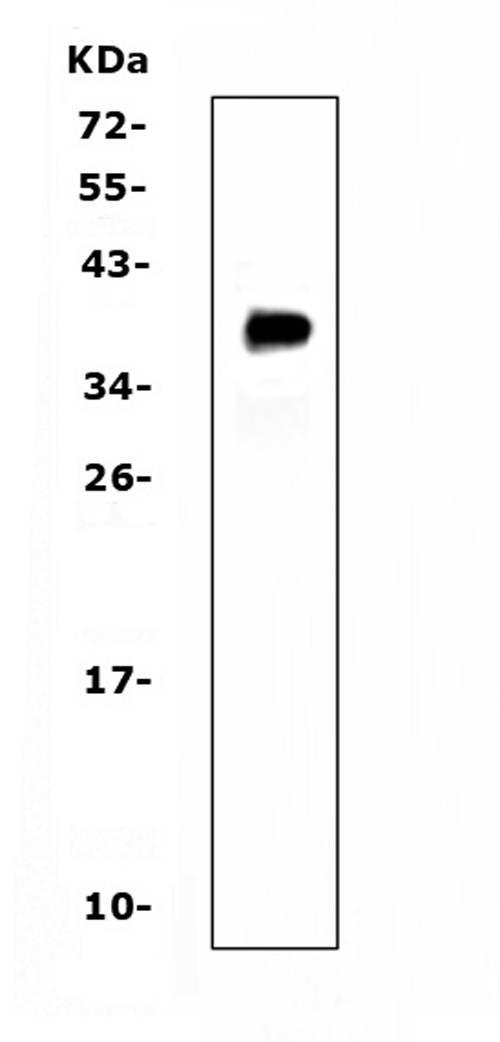 TNFRSF13B / TACI Antibody - Western blot analysis of TACI using anti-TACI antibody. Electrophoresis was performed on a 5-20% SDS-PAGE gel at 70V (Stacking gel) / 90V (Resolving gel) for 2-3 hours. Lane 1: recombinant human TACI protein 1ng. After Electrophoresis, proteins were transferred to a Nitrocellulose membrane at 150mA for 50-90 minutes. Blocked the membrane with 5% Non-fat Milk/ TBS for 1.5 hour at RT. The membrane was incubated with rabbit anti-TACI antigen affinity purified polyclonal antibody at 0.5 µg/mL overnight at 4°C, then washed with TBS-0.1% Tween 3 times with 5 minutes each and probed with a goat anti-rabbit IgG-HRP secondary antibody at a dilution of 1:10000 for 1.5 hour at RT. The signal is developed using an Enhanced Chemiluminescent detection (ECL) kit with Tanon 5200 system. A specific band was detected for TACI at approximately 40KD. The expected band size for TACI is at 32KD.