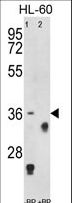 TNFRSF14 / CD270 / HVEM Antibody - Western blot of anti-TNFRSF14 Antibody antibody pre-incubated without(lane 1) and with(lane 2) blocking peptide in HL-60 cell line lysate. TNFRSF14 (arrow) was detected using the purified antibody.