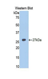 TNFRSF14 / CD270 / HVEM Antibody - Western blot of recombinant TNFRSF14 / CD270 / HVEM.  This image was taken for the unconjugated form of this product. Other forms have not been tested.