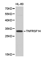 TNFRSF14 / CD270 / HVEM Antibody - Western blot of extracts of HL-60 cell lines, using TNFRSF14 antibody.