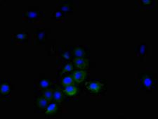 TNFRSF14 / CD270 / HVEM Antibody - Immunofluorescent analysis of A431 cells using TNFSF14 Antibody at dilution of 1:100 and Alexa Fluor 488-congugated AffiniPure Goat Anti-Rabbit IgG(H+L)