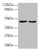 TNFRSF14 / CD270 / HVEM Antibody - Western blot All lanes: Tumor necrosis factor ligand superfamily member 14 antibody at 2µg/ml Lane 1: EC109 whole cell lysate Lane 2: 293T whole cell lysate Secondary Goat polyclonal to rabbit IgG at 1/15000 dilution Predicted band size: 27, 23 kDa Observed band size: 45, 60 kDa
