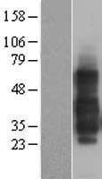 TNFRSF14 / CD270 / HVEM Protein - Western validation with an anti-DDK antibody * L: Control HEK293 lysate R: Over-expression lysate