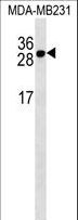 TNFRSF17 / BCMA Antibody - TNFRSF17 Antibody western blot of MDA-MB231 cell line lysates (35 ug/lane). The TNFRSF17 antibody detected the TNFRSF17 protein (arrow).