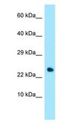 TNFRSF17 / BCMA Antibody - TNFRSF17 / BCMA antibody Western Blot of Human heart.  This image was taken for the unconjugated form of this product. Other forms have not been tested.