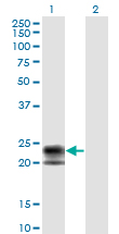TNFRSF17 / BCMA Antibody - Western Blot analysis of TNFRSF17 expression in transfected 293T cell line by TNFRSF17 monoclonal antibody (M01), clone 1F10.Lane 1: TNFRSF17 transfected lysate(20.1 KDa).Lane 2: Non-transfected lysate.