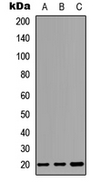 TNFRSF17 / BCMA Antibody - Western blot analysis of CD269 expression in HEK293T (A); Raw264.7 (B); PC12 (C) whole cell lysates.