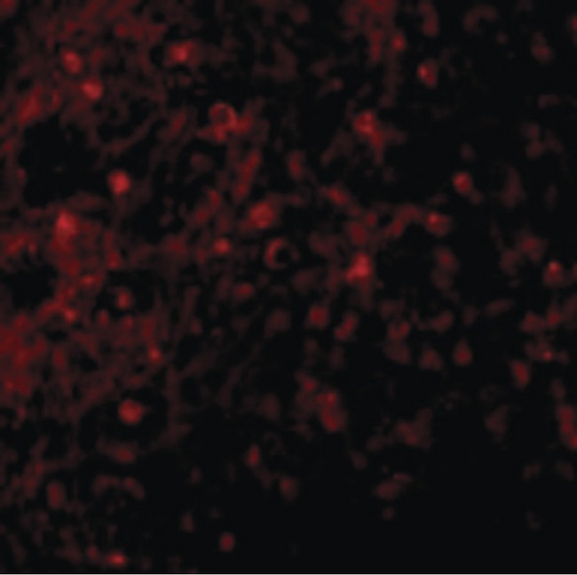 TNFRSF17 / BCMA Antibody - Immunofluorescence of BCMA in Human Spleen cells with BCMA antibody at 10 ug/ml.