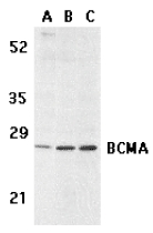 TNFRSF17 / BCMA Antibody - Western blot of BCMA in human spleen (A) tissue lysate, K562 (B), and U937 (C) cell lysates with BCMA antibody at 5 ug/ml.