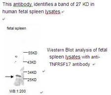 TNFRSF17 / BCMA Antibody