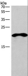 TNFRSF17 / BCMA Antibody - Western blot analysis of Mouse skeletal muscle tissue, using TNFRSF17 Polyclonal Antibody at dilution of 1:200.