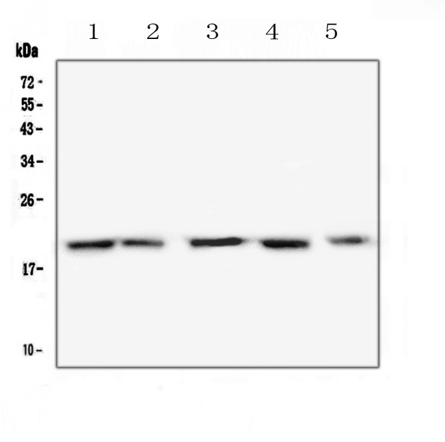 TNFRSF17 / BCMA Antibody - Western blot analysis of BCMA using anti-BCMA antibody. Electrophoresis was performed on a 5-20% SDS-PAGE gel at 70V (Stacking gel) / 90V (Resolving gel) for 2-3 hours. The sample well of each lane was loaded with 50ug of sample under reducing conditions. Lane 1: mouse spleen tissue lysates,Lane 2: mouse thymus tissue lysates,Lane 3: mouse lung tissue lysates,Lane 4: mouse testis tissue lysates,Lane 5: mouse NIH3T3 whole cell lysates. After Electrophoresis, proteins were transferred to a Nitrocellulose membrane at 150mA for 50-90 minutes. Blocked the membrane with 5% Non-fat Milk/ TBS for 1.5 hour at RT. The membrane was incubated with rabbit anti-BCMA antigen affinity purified polyclonal antibody at 0.5 µg/mL overnight at 4°C, then washed with TBS-0.1% Tween 3 times with 5 minutes each and probed with a goat anti-rabbit IgG-HRP secondary antibody at a dilution of 1:10000 for 1.5 hour at RT. The signal is developed using an Enhanced Chemiluminescent detection (ECL) kit with Tanon 5200 system. A specific band was detected for BCMA at approximately 20KD. The expected band size for BCMA is at 20KD.