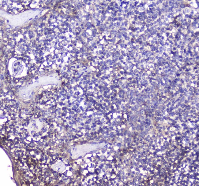 TNFRSF17 / BCMA Antibody - Immunohistochemistry - Anti-BCMA Picoband antibody