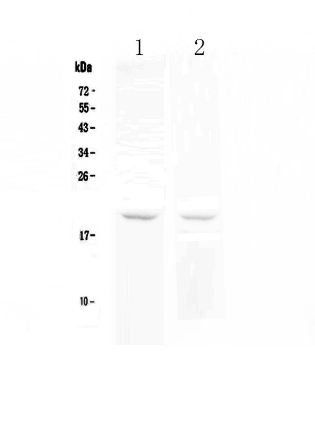 TNFRSF17 / BCMA Antibody - Western blot analysis of BCMA using anti-BCMA antibody. Electrophoresis was performed on a 5-20% SDS-PAGE gel at 70V (Stacking gel) / 90V (Resolving gel) for 2-3 hours. The sample well of each lane was loaded with 50ug of sample under reducing conditions. Lane 1: human Raji whole cell lysates, Lane 2: human Jurkat whole cell lysates. After Electrophoresis, proteins were transferred to a Nitrocellulose membrane at 150mA for 50-90 minutes. Blocked the membrane with 5% Non-fat Milk/ TBS for 1.5 hour at RT. The membrane was incubated with rabbit anti-BCMA antigen affinity purified polyclonal antibody at 0.5 µg/mL overnight at 4°C, then washed with TBS-0.1% Tween 3 times with 5 minutes each and probed with a goat anti-rabbit IgG-HRP secondary antibody at a dilution of 1:10000 for 1.5 hour at RT. The signal is developed using an Enhanced Chemiluminescent detection (ECL) kit with Tanon 5200 system. A specific band was detected for BCMA at approximately 20KD. The expected band size for BCMA is at 20KD.