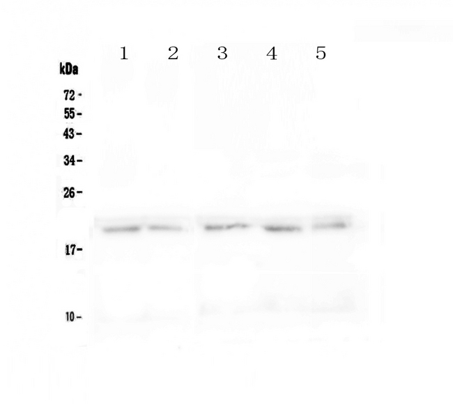 TNFRSF17 / BCMA Antibody - Western blot - Anti-BCMA Picoband antibody