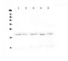 TNFRSF17 / BCMA Antibody - Western blot - Anti-BCMA Picoband antibody