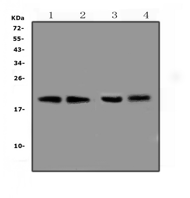 TNFRSF17 / BCMA Antibody - Western blot analysis of BCMA using anti-BCMA antibody. Electrophoresis was performed on a 5-20% SDS-PAGE gel at 70V (Stacking gel) / 90V (Resolving gel) for 2-3 hours. The sample well of each lane was loaded with 50ug of sample under reducing conditions. Lane 1: rat spleen tissue lysates,Lane 2: rat thymus tissue lysates,Lane 3: rat lung tissue lysates,Lane 4: rat testis tissue lysates. After Electrophoresis, proteins were transferred to a Nitrocellulose membrane at 150mA for 50-90 minutes. Blocked the membrane with 5% Non-fat Milk/ TBS for 1.5 hour at RT. The membrane was incubated with rabbit anti-BCMA antigen affinity purified polyclonal antibody at 0.5 µg/mL overnight at 4°C, then washed with TBS-0.1% Tween 3 times with 5 minutes each and probed with a goat anti-rabbit IgG-HRP secondary antibody at a dilution of 1:10000 for 1.5 hour at RT. The signal is developed using an Enhanced Chemiluminescent detection (ECL) kit with Tanon 5200 system. A specific band was detected for BCMA at approximately 20KD. The expected band size for BCMA is at 20KD.