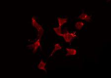 TNFRSF17 / BCMA Antibody - Staining HeLa cells by IF/ICC. The samples were fixed with PFA and permeabilized in 0.1% Triton X-100, then blocked in 10% serum for 45 min at 25°C. The primary antibody was diluted at 1:200 and incubated with the sample for 1 hour at 37°C. An Alexa Fluor 594 conjugated goat anti-rabbit IgG (H+L) Ab, diluted at 1/600, was used as the secondary antibody.