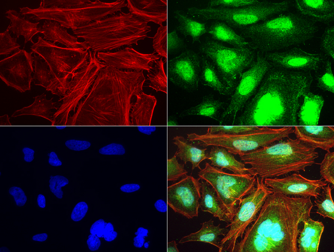 TNFRSF18 / GITR Antibody - Immunofluorescent staining of HeLa cells using anti-TNFRSF18 mouse monoclonal antibody  green, 1:50). Actin filaments were labeled with Alexa Fluor® 594 Phalloidin. (red), and nuclear with DAPI. (blue).