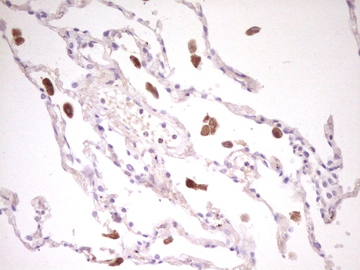 TNFRSF18 / GITR Antibody - Immunohistochemical staining of paraffin-embedded Human lung tissue using anti-TNFRSF18 mouse monoclonal antibody. (Heat-induced epitope retrieval by 1mM EDTA in 10mM Tris buffer. (pH8.0) at 120C for 3 min. (1:200)
