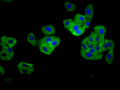 TNFRSF18 / GITR Antibody - Immunofluorescence staining of HepG2 cells diluted at 1:166, counter-stained with DAPI. The cells were fixed in 4% formaldehyde, permeabilized using 0.2% Triton X-100 and blocked in 10% normal Goat Serum. The cells were then incubated with the antibody overnight at 4°C.The Secondary antibody was Alexa Fluor 488-congugated AffiniPure Goat Anti-Rabbit IgG (H+L).