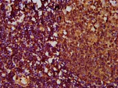 TNFRSF18 / GITR Antibody - Immunohistochemistry Dilution at 1:500 and staining in paraffin-embedded human lymph node tissue performed on a Leica BondTM system. After dewaxing and hydration, antigen retrieval was mediated by high pressure in a citrate buffer (pH 6.0). Section was blocked with 10% normal Goat serum 30min at RT. Then primary antibody (1% BSA) was incubated at 4°C overnight. The primary is detected by a biotinylated Secondary antibody and visualized using an HRP conjugated SP system.