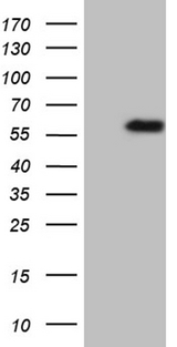 TNFRSF19 / TROY Antibody - HEK293T cells were transfected with the pCMV6-ENTRY control. (Left lane) or pCMV6-ENTRY TNFRSF19. (Right lane) cDNA for 48 hrs and lysed. Equivalent amounts of cell lysates. (5 ug per lane) were separated by SDS-PAGE and immunoblotted with anti-TNFRSF19. (1:2000)