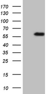 TNFRSF19 / TROY Antibody - HEK293T cells were transfected with the pCMV6-ENTRY control. (Left lane) or pCMV6-ENTRY TNFRSF19. (Right lane) cDNA for 48 hrs and lysed. Equivalent amounts of cell lysates. (5 ug per lane) were separated by SDS-PAGE and immunoblotted with anti-TNFRSF19. (1:2000)
