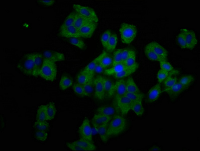 TNFRSF19 / TROY Antibody - Immunofluorescence staining of HepG2 cells at a dilution of 1:200, counter-stained with DAPI. The cells were fixed in 4% formaldehyde, permeabilized using 0.2% Triton X-100 and blocked in 10% normal Goat Serum. The cells were then incubated with the antibody overnight at 4 °C.The secondary antibody was Alexa Fluor 488-congugated AffiniPure Goat Anti-Rabbit IgG (H+L) .