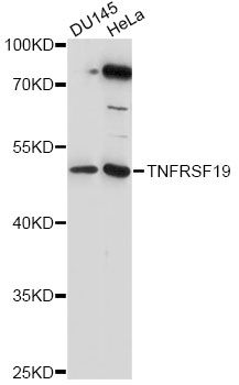 TNFRSF19 / TROY Antibody - Western blot analysis of extracts of various cell lines, using TNFRSF19 antibody at 1:1000 dilution. The secondary antibody used was an HRP Goat Anti-Rabbit IgG (H+L) at 1:10000 dilution. Lysates were loaded 25ug per lane and 3% nonfat dry milk in TBST was used for blocking. An ECL Kit was used for detection and the exposure time was 90s.