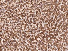 TNFRSF19 / TROY Antibody - Immunochemical staining of human TNFRSF19 in human liver with rabbit polyclonal antibody at 1:500 dilution, formalin-fixed paraffin embedded sections.