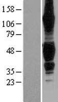 TNFRSF19 / TROY Protein - Western validation with an anti-DDK antibody * L: Control HEK293 lysate R: Over-expression lysate