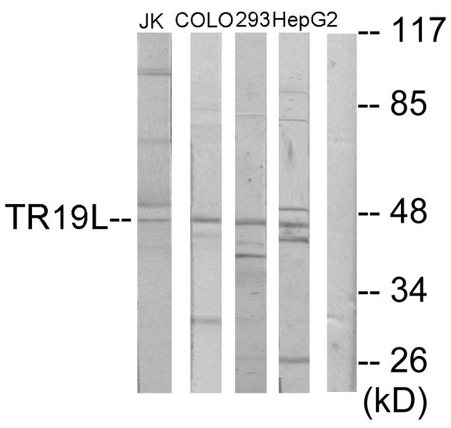 TNFRSF19L / RELT Antibody - Western blot analysis of lysates from Jurkat, COLO205, 293, and HepG2 cells, using RELT Antibody. The lane on the right is blocked with the synthesized peptide.