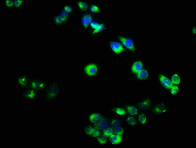 TNFRSF19L / RELT Antibody - Immunofluorescence staining of PC3 cells with RELT Antibody at 1:40, counter-stained with DAPI. The cells were fixed in 4% formaldehyde, permeabilized using 0.2% Triton X-100 and blocked in 10% normal Goat Serum. The cells were then incubated with the antibody overnight at 4°C. The secondary antibody was Alexa Fluor 488-congugated AffiniPure Goat Anti-Rabbit IgG(H+L).