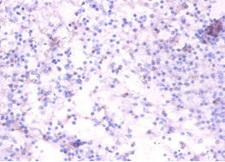 TNFRSF19L / RELT Antibody - Immunohistochemistry of paraffin-embedded human spleen tissue using RELT Antibody at dilution of 1:100