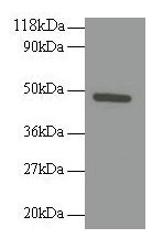 TNFRSF19L / RELT Antibody - Western blot All lanes: Tumor necrosis factor receptor superfamily member 19L antibody at 2µg/ml + 293T whole cell lysate Secondary Goat polyclonal to rabbit IgG at 1/10000 dilution Predicted band size: 47 kDa Observed band size: 47 kDa