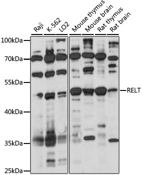 TNFRSF19L / RELT Antibody - Western blot analysis of extracts of various cell lines, using RELT antibody at 1:1000 dilution. The secondary antibody used was an HRP Goat Anti-Rabbit IgG (H+L) at 1:10000 dilution. Lysates were loaded 25ug per lane and 3% nonfat dry milk in TBST was used for blocking. An ECL Kit was used for detection and the exposure time was 60S.