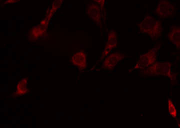 TNFRSF19L / RELT Antibody - Staining HeLa cells by IF/ICC. The samples were fixed with PFA and permeabilized in 0.1% Triton X-100, then blocked in 10% serum for 45 min at 25°C. The primary antibody was diluted at 1:200 and incubated with the sample for 1 hour at 37°C. An Alexa Fluor 594 conjugated goat anti-rabbit IgG (H+L) Ab, diluted at 1/600, was used as the secondary antibody.