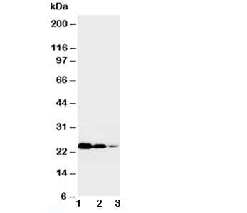 TNFRSF1A / TNFR1 Antibody - Western blot testing of TNFR1 antibody and Lane 1: Recombinant human TNFR1 protein 10ng; 2: 5ng; 3: 2.5ng