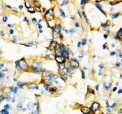 TNFRSF1A / TNFR1 Antibody - IHC-P: TNFR1 antibody testing of human breast tissue