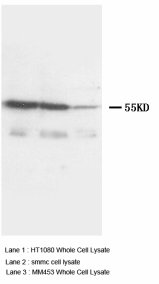 TNFRSF1A / TNFR1 Antibody -  This image was taken for the unconjugated form of this product. Other forms have not been tested.