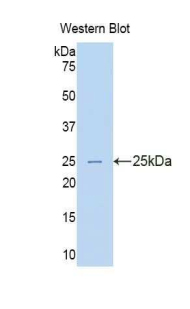 TNFRSF1A / TNFR1 Antibody - Western blot of recombinant TNFRSF1A / TNFR1.  This image was taken for the unconjugated form of this product. Other forms have not been tested.