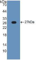 TNFRSF1A / TNFR1 Antibody - Western Blot; Sample: Recombinant TNFRSF1A, Human.