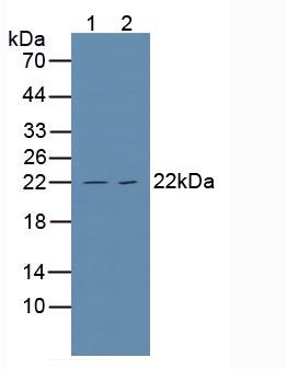 TNFRSF1A / TNFR1 Antibody - Western Blot; Sample: Lane1: Human Hela Cells; Lane2: Human Jurkat Cells.