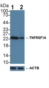 TNFRSF1A / TNFR1 Antibody - Knockout Varification: Lane 1: Wild-type Hela cell lysate; Lane 2: TNFRSF1A knockout Hela cell lysate; Predicted MW: 50,38,25kDa Observed MW: 23kDa Primary Ab: 3µg/ml Rabbit Anti-Human TNFRSF1A Antibody Second Ab: 0.2µg/mL HRP-Linked Caprine Anti-Rabbit IgG Polyclonal Antibody