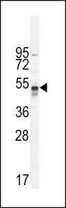 TNFRSF1A / TNFR1 Antibody - hTNFR-pS274 western blot of A549 cell line lysates (35 ug/lane). The TNFR antibody detected the TNFR protein (arrow).
